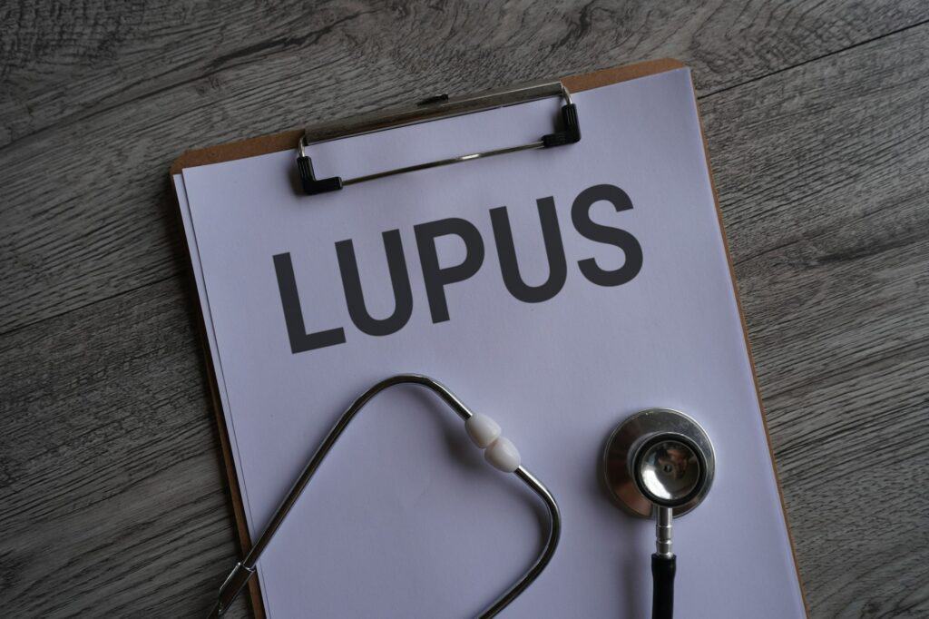Top view image of stethoscope and paper clipboard with text LUPUS.