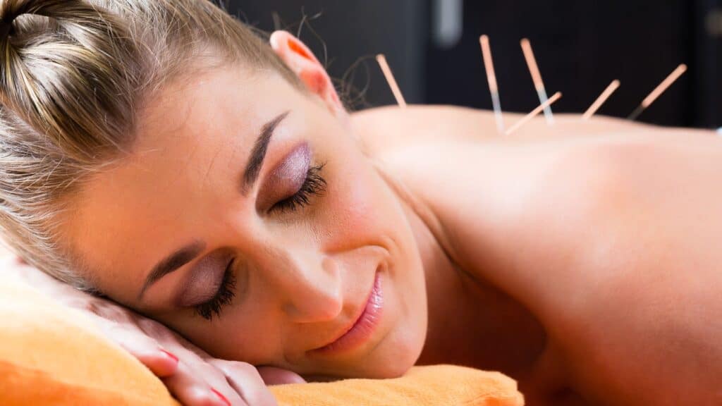 Exploring the Benefits of Acupuncture for Health Transformation